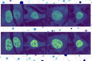 Two rows of cells under a microscope. The top row shows the model’s prediction of unseen cell lines and proteins, while the bottom row shows the experimental validation.